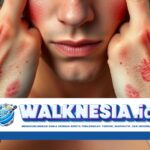 Kenali dan Atasi Dermatitis Berdasarkan Jenisnya dengan Cara yang Tepat